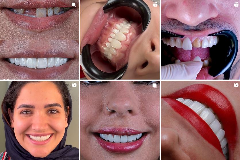 دکتر مهرداد فلاح دندانپزشک زیبایی