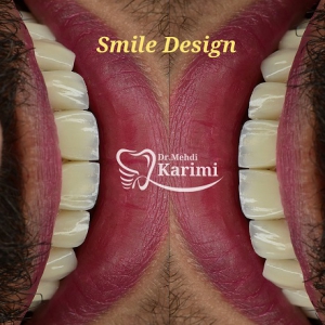 دندان پزشکی دکتر کریمی در سعادت آباد