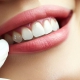 دندانپزشکی زیبایی در تجریش